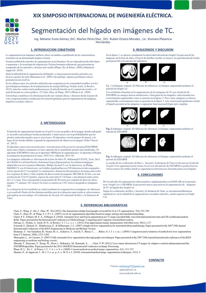 Liver segmentation on CT images.