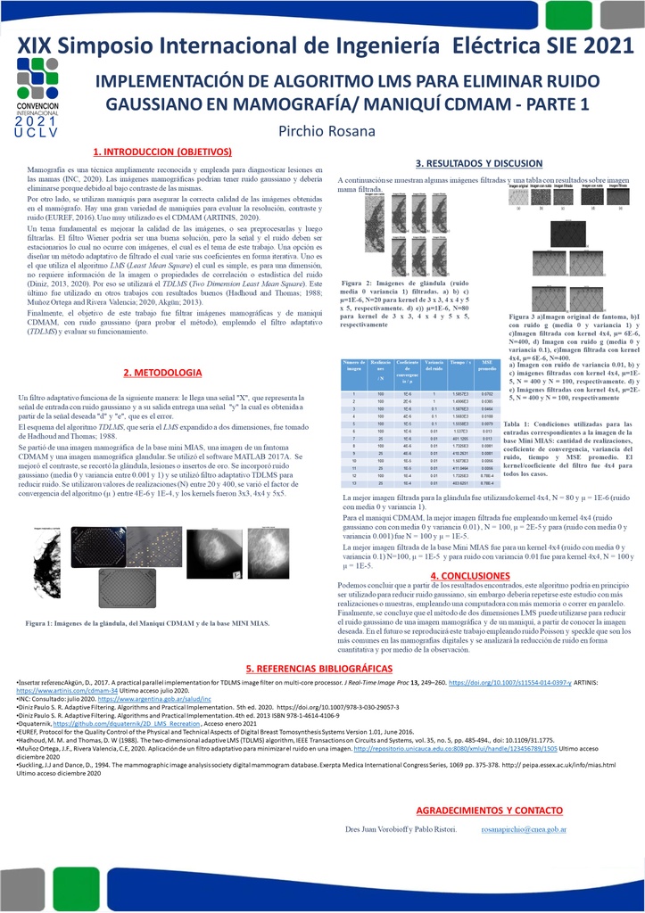 LMS  algorithm implementation to eliminate Gaussian noise in mammographic images and CDMAM phantom.